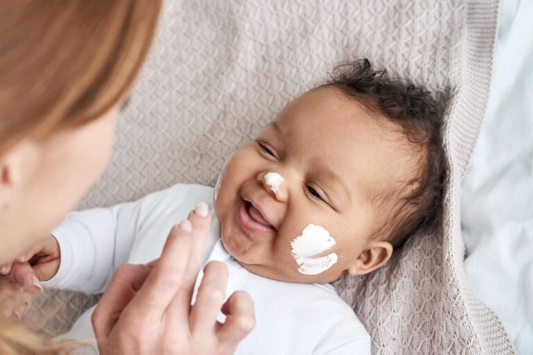 qual a melhor pomada para assadura de bebê recém nascido?